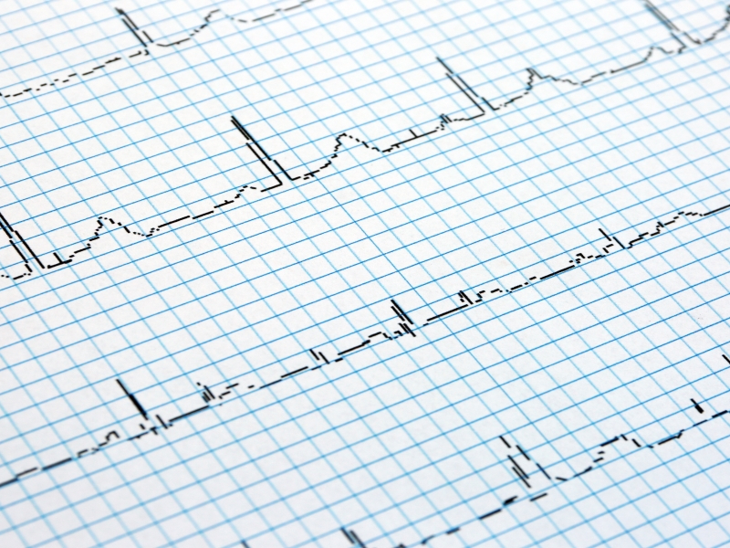 A heart monitor reading on a piece of paper